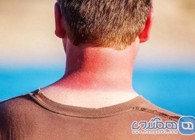 چطور در سفرهای ساحلی دچار آفتاب سوختگی نشویم؟ چطور در سفرهای ساحلی دچار آفتاب سوختگی نشویم؟